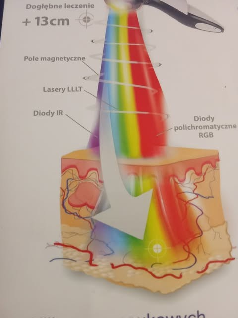 4.MILTA PLUS.jpg